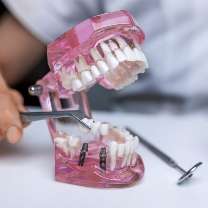 Crown Vs. Bridge What You Need to Know Dutton Dental Concepts, Inc.